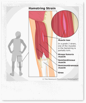 Physical therapy for a pulled hamstring muscle