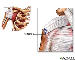 rotator cuff PT 2