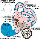 Vestibular Physical Therapy 32