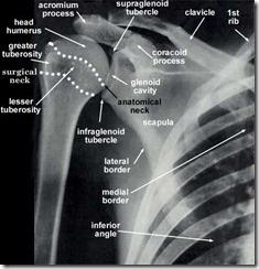 Best Phsyical Therapist NYC Shoulder Fracture Physical Therapy 01