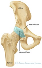 Best Physical Therapist NYC for Total Hip Replacement 01