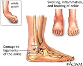 Physical Therapy for Ankle Pain NYC PO1.jpg