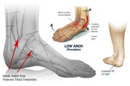 Physical Therapy for Ankle Pain NYC PO2.jpg