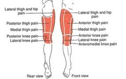 Physical Therapy for Thigh Pain NYC 1