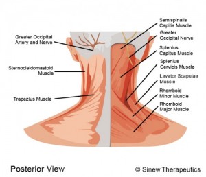 Neck pain