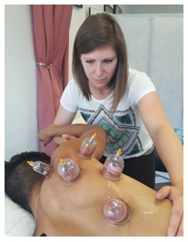 cupping procedure nyc p03