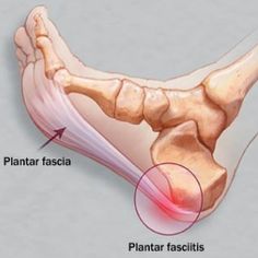 plantar fascia fascitis foot anatomy